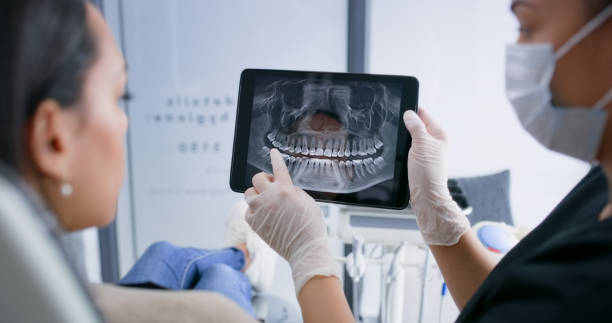 Licensed Dental Implants service in Indianapolis, IN - Smile Center Dentistry